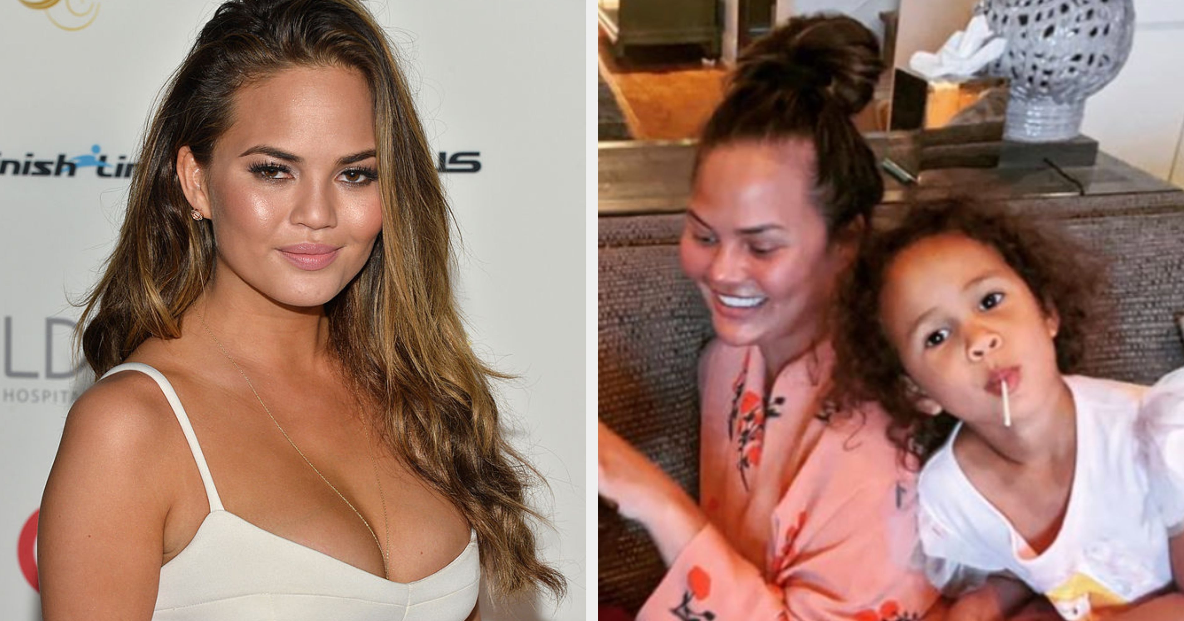 Chrissy Teigen's Breast Implants Have Been Removed And Her Update Is Priceless