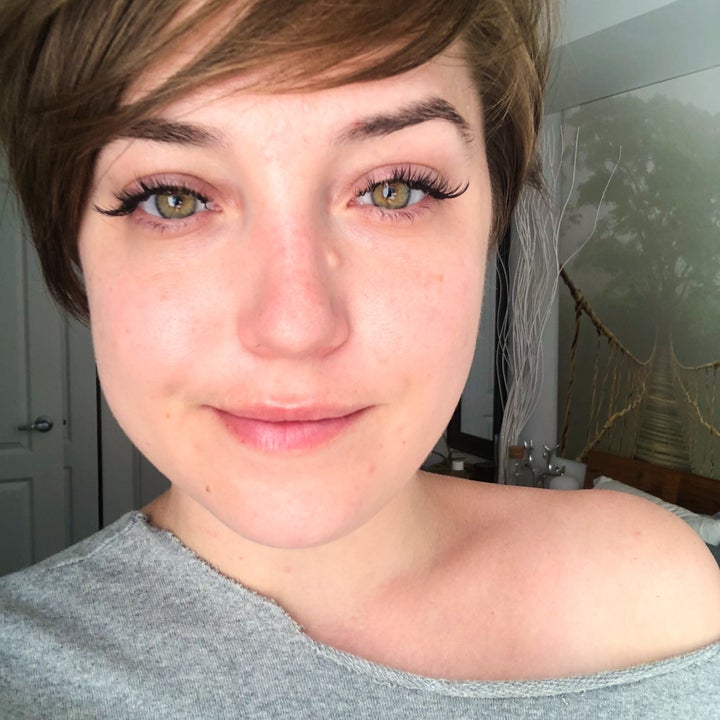 A close-up of a makeup free face with no visible blemishes
