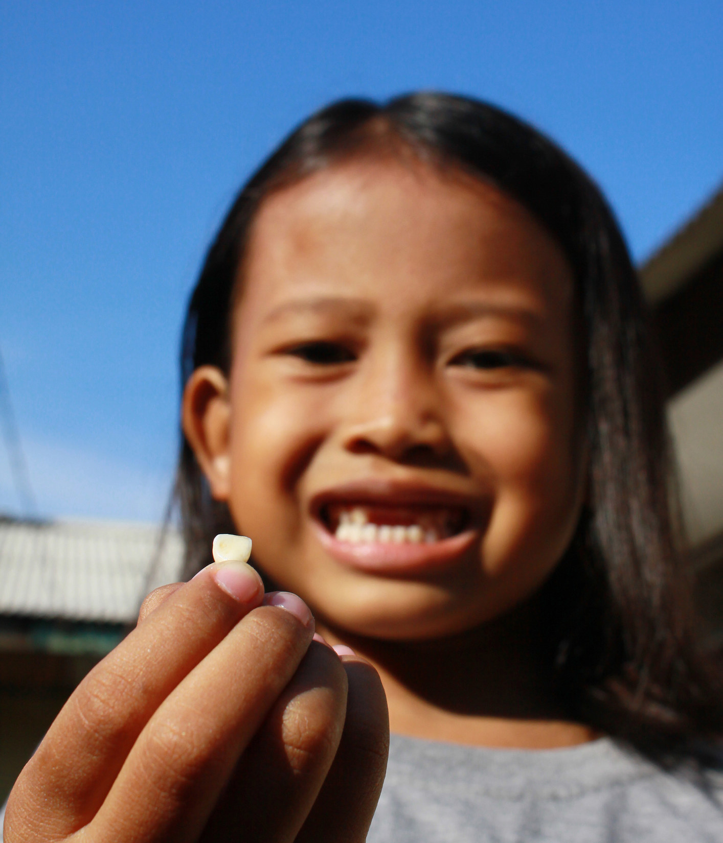 a child holding their missing tooth