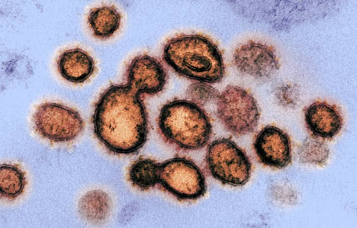 Coronavirus particles