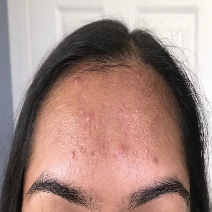 An "after" pic of the same reviewer without oil on their forehead 