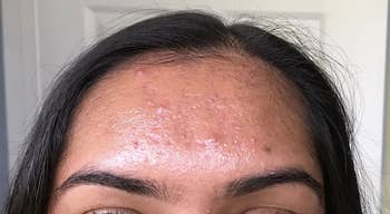 A reviewer's forehead shiny with oil 