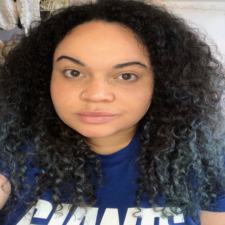 BuzzFeed Shopping editor after using the concealer with no trace of redness or the pimple and the eye bags are much, much lighter. Her face looks very smooth and even.