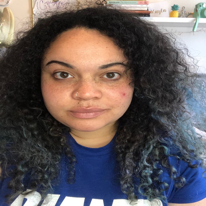 BuzzFeed Shopping editor before using the concealer with some visible dark circles, some redness, and a pimple on her cheek