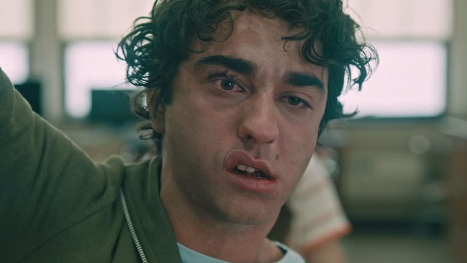 Actor Alex Wolff in &quot;Hereditary&quot; looking very beat-up.