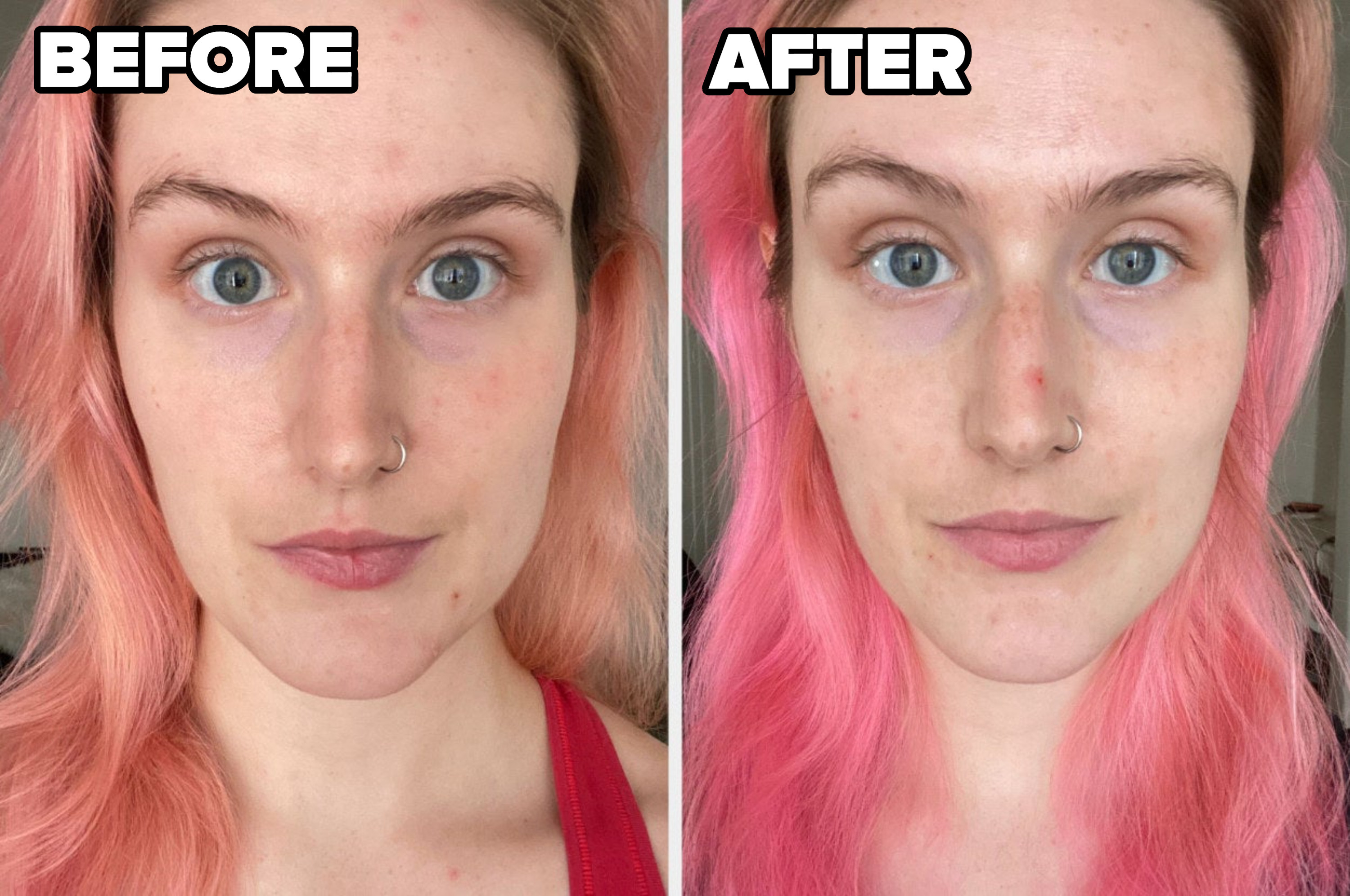 These Viral Tiktok Skincare Products Were A Journey