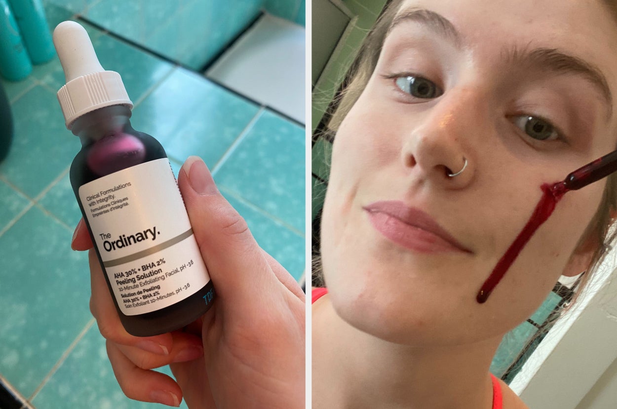 tiktok acne products