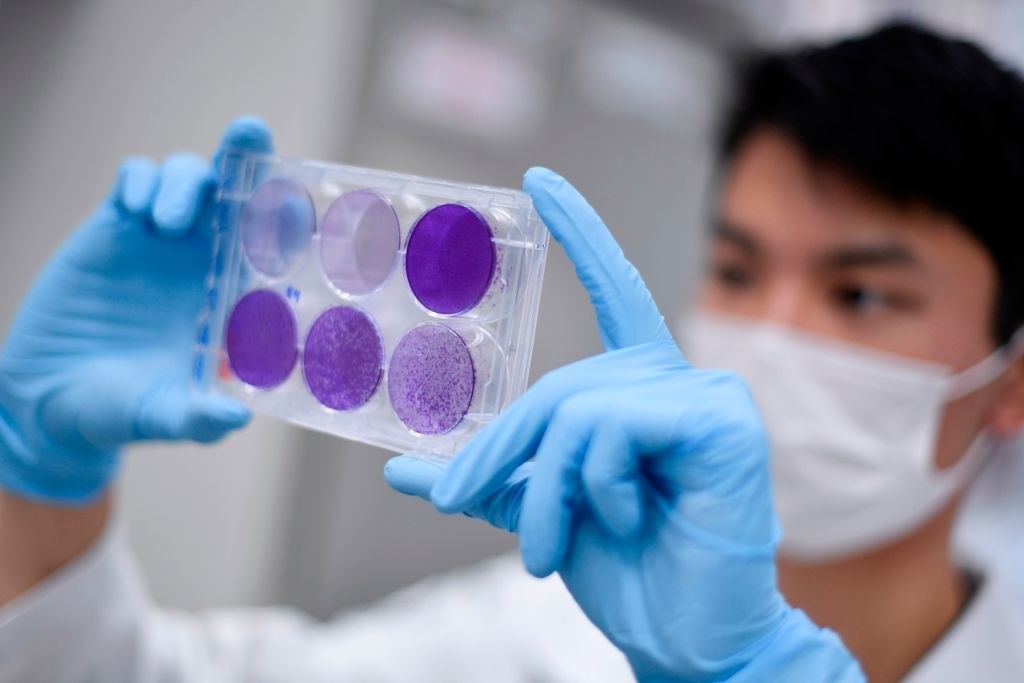 Photo of a coronavirus researcher