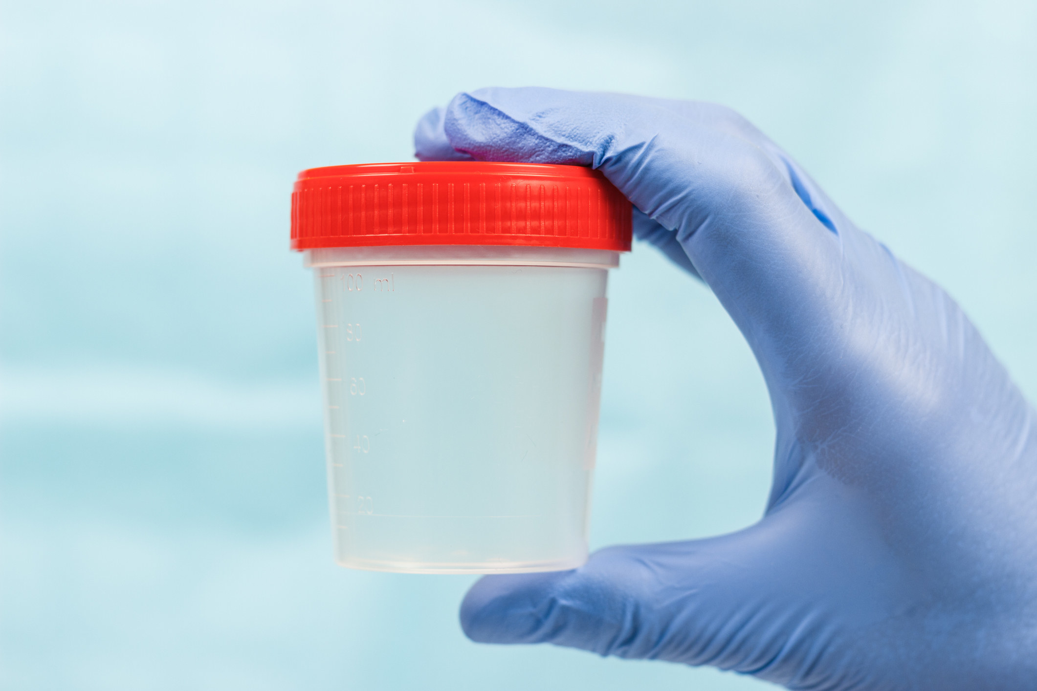 Gloved hand of a medical worker holding a plastic donor cup