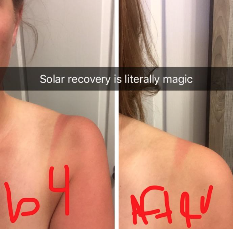 12 Products That Reviewers Say Treat Sunburns Really Well