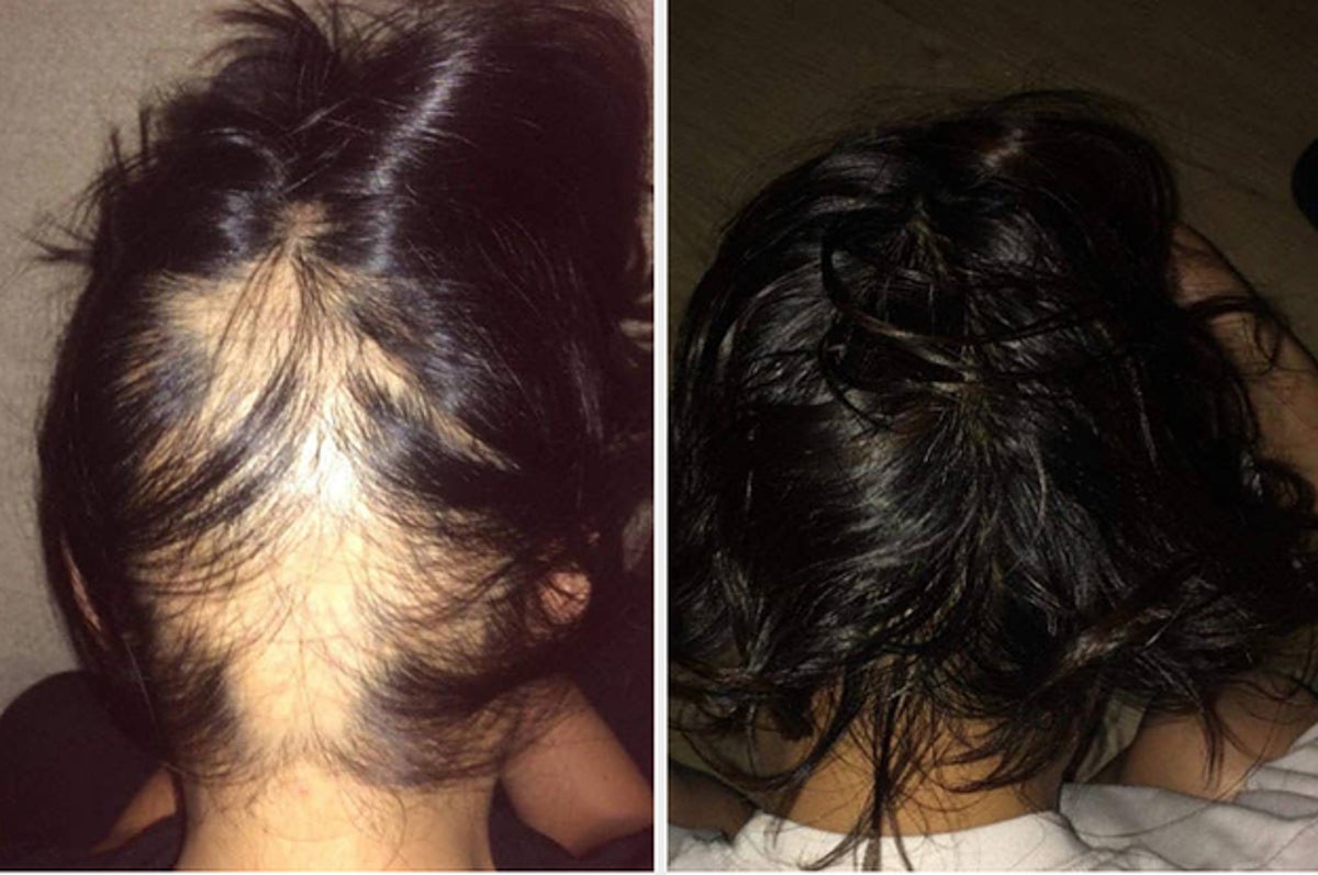 Just 26 Hair Products With Impressive Before-And-After Photos