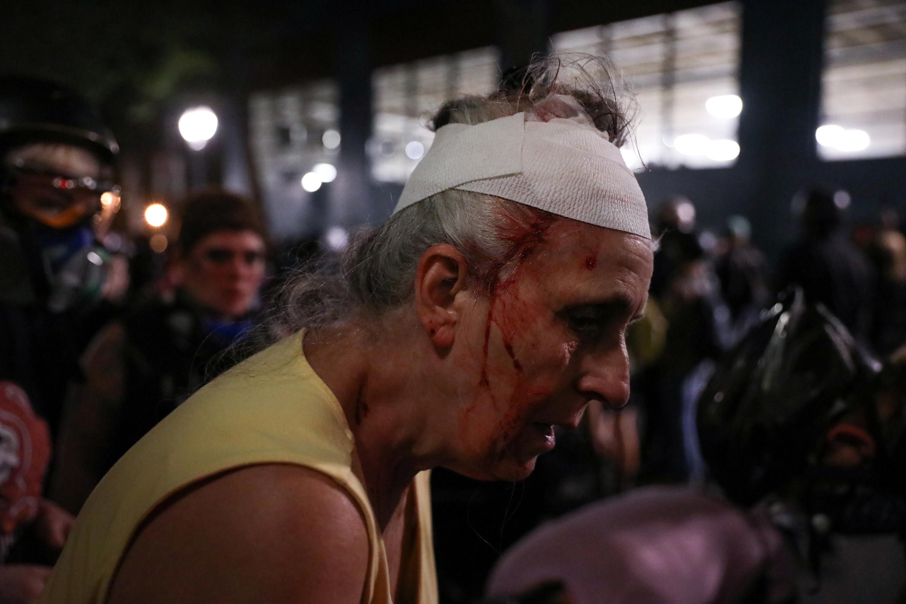 An older woman with a bandage on her head has blood stream down her face after being injured during a demonstration in Portland