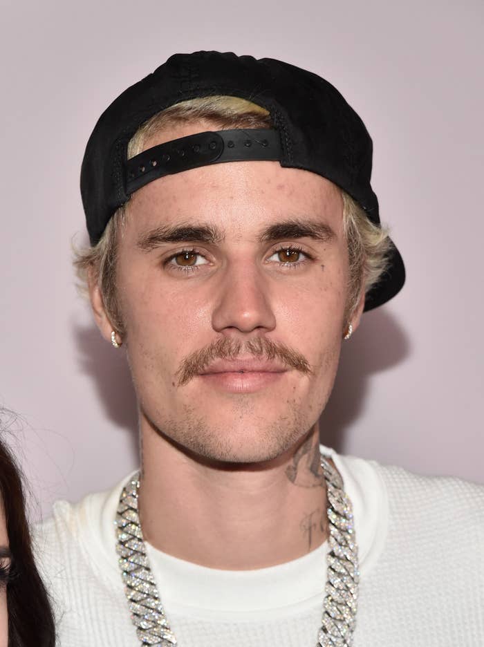 Justin Bieber wears a hat at an event with visibly adult acne on his forehead