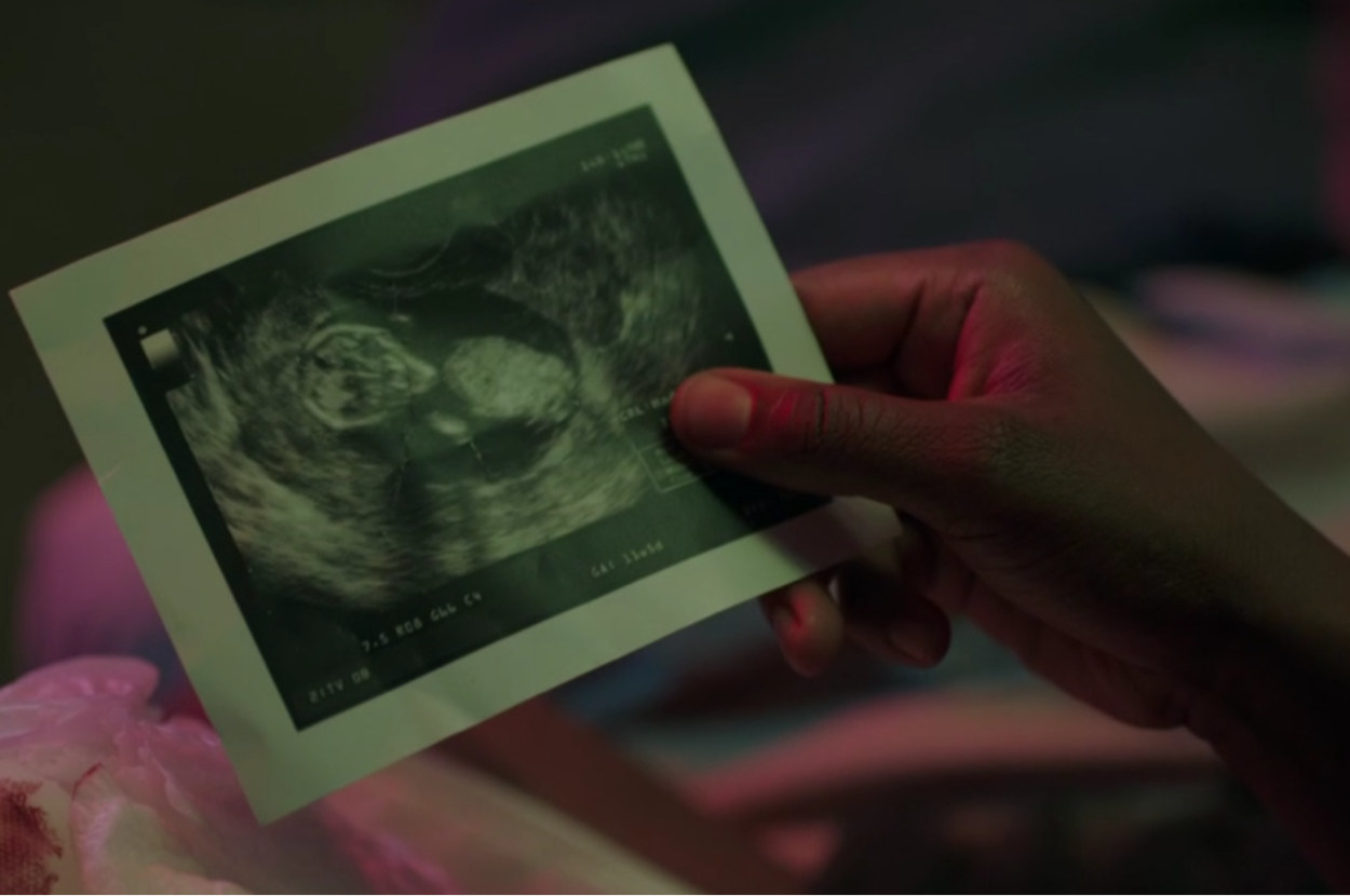 A hand holds a picture of an ultrasound