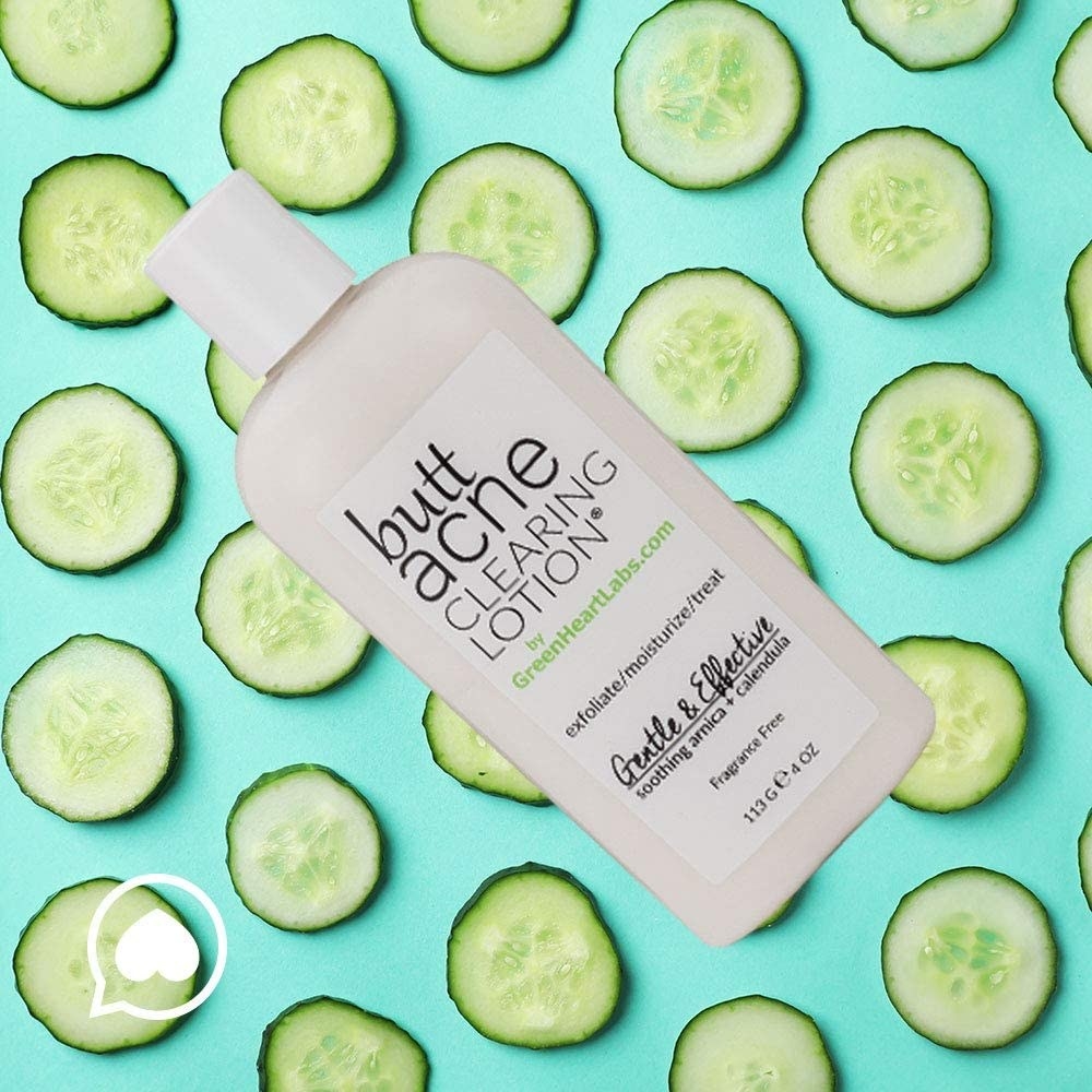 A bottle of acne clearing lotion on sliced cucumbers