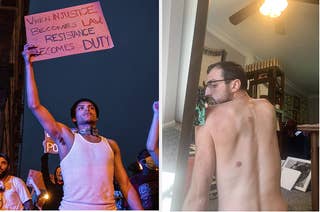 Left, a protester holds up a sign during a march. Right, a protester shows welts after a confrontation with police.