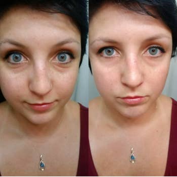 On the left, a reviewer with creases and dark circles under their eyes. On the right, the same reviewer with the creases and circles largely faded