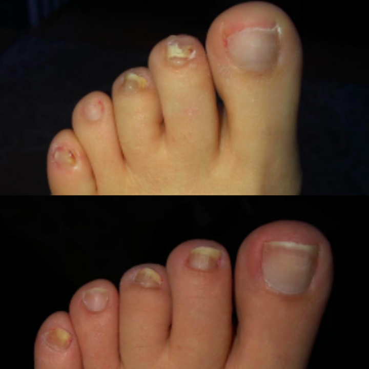 17 Products That Might Actually Help With Foot Fungus