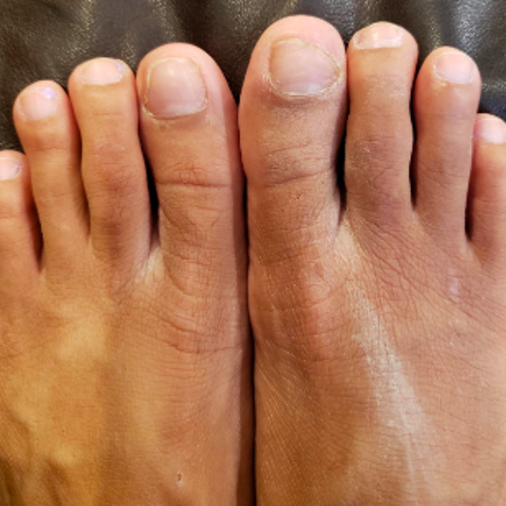 17 Products That Might Actually Help With Foot Fungus