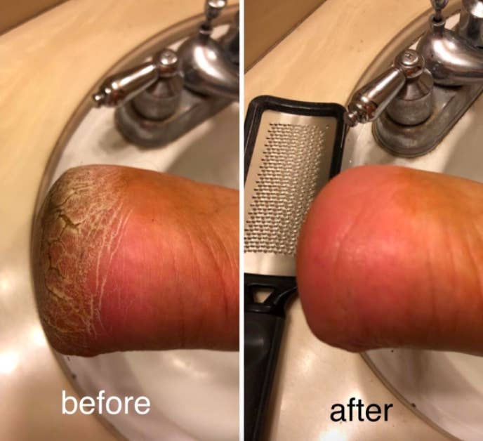 A customer review photo showing their heel before and after using the foot file.