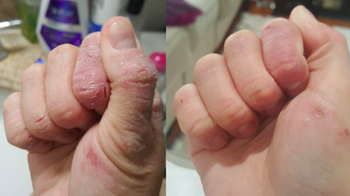 A customer review photo showing their hand before and after using the hand cream.