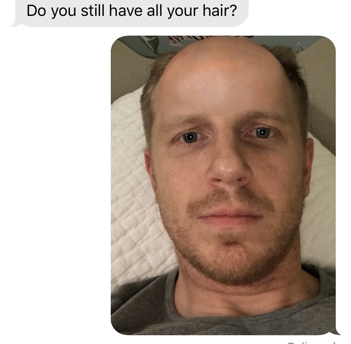Catherine Lowe texts Sean &quot;Do you still have all your hair&quot; and he responds with a pic where he look seemingly bald on top.