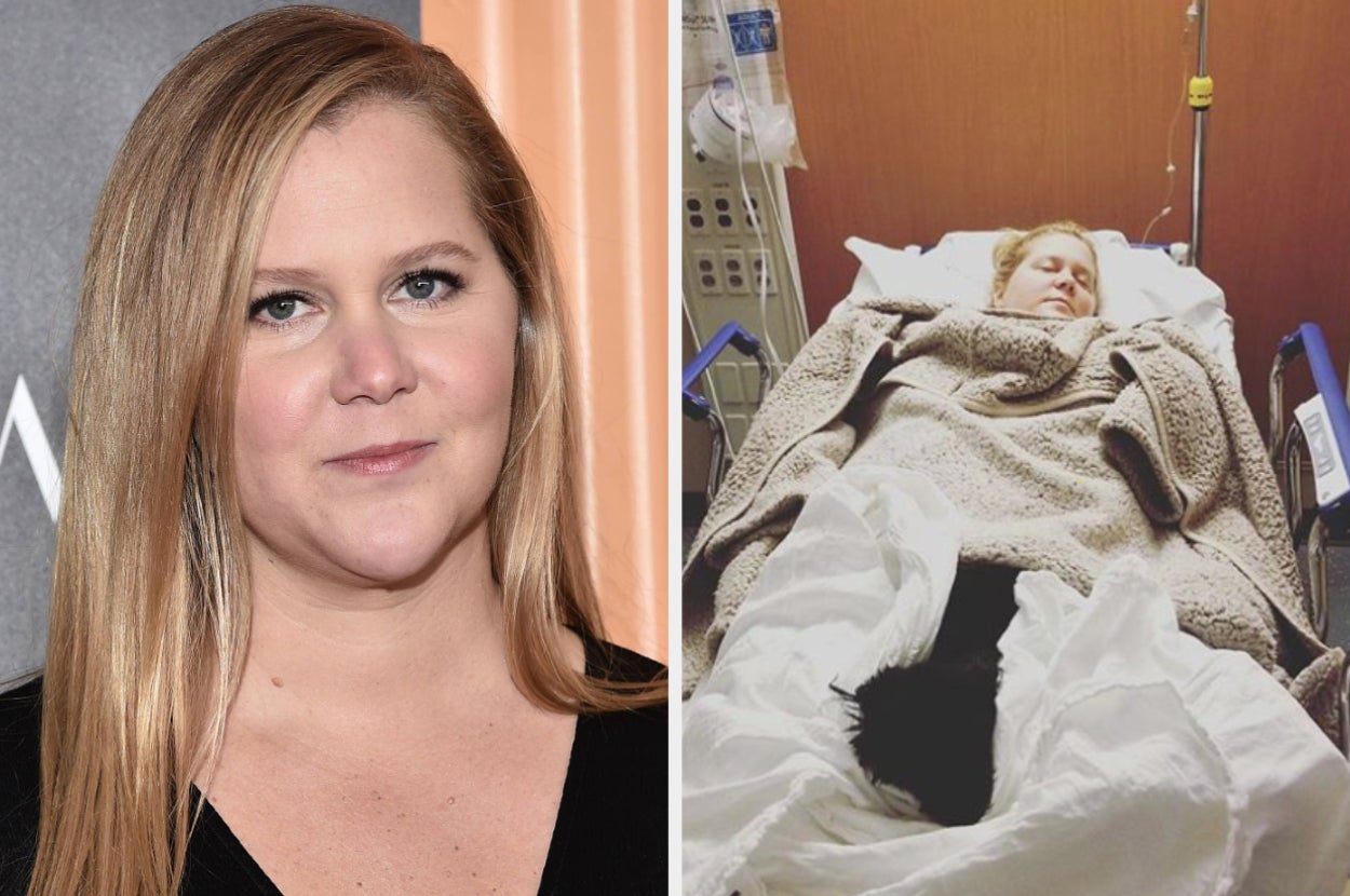 Amy Schumer Spoke About Working Through Hyperemesis Gravidarum And