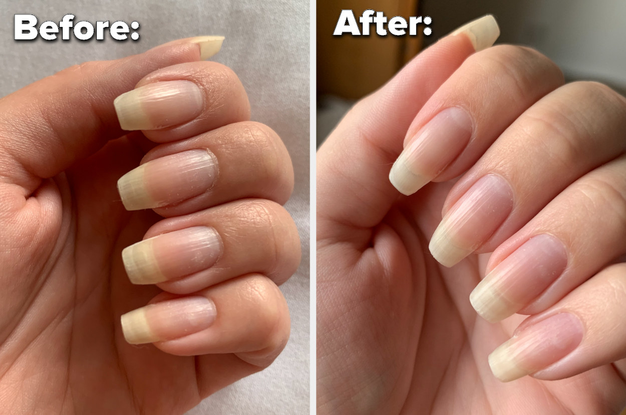 A before image of a person&#x27;s nails looking dry, overgrown cuticles, and an after image of their nails looking hydrated and healthy