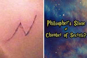 Is this closeup of the lightning scar from Philosopher's Stone or Chamber of Secrets?