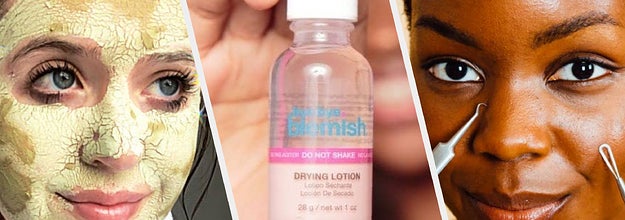 holy grail acne products