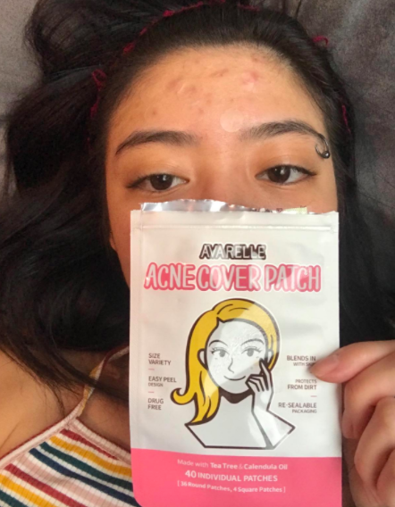 Reviewer photo showing Avarelle Acne Cover Patch packaging as well as a few of the patches on their face 