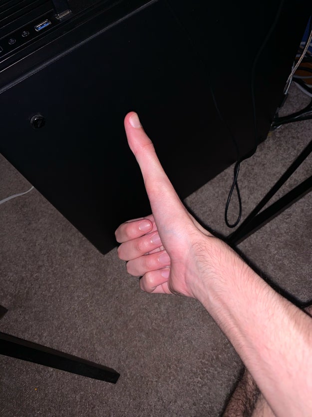 ガチ 5センチの親指を14センチに伸ばせる男 現る