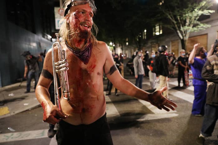 A protester with blood on their face and body, goggles on their forehead, and holding a trumpet stands in the busy street
