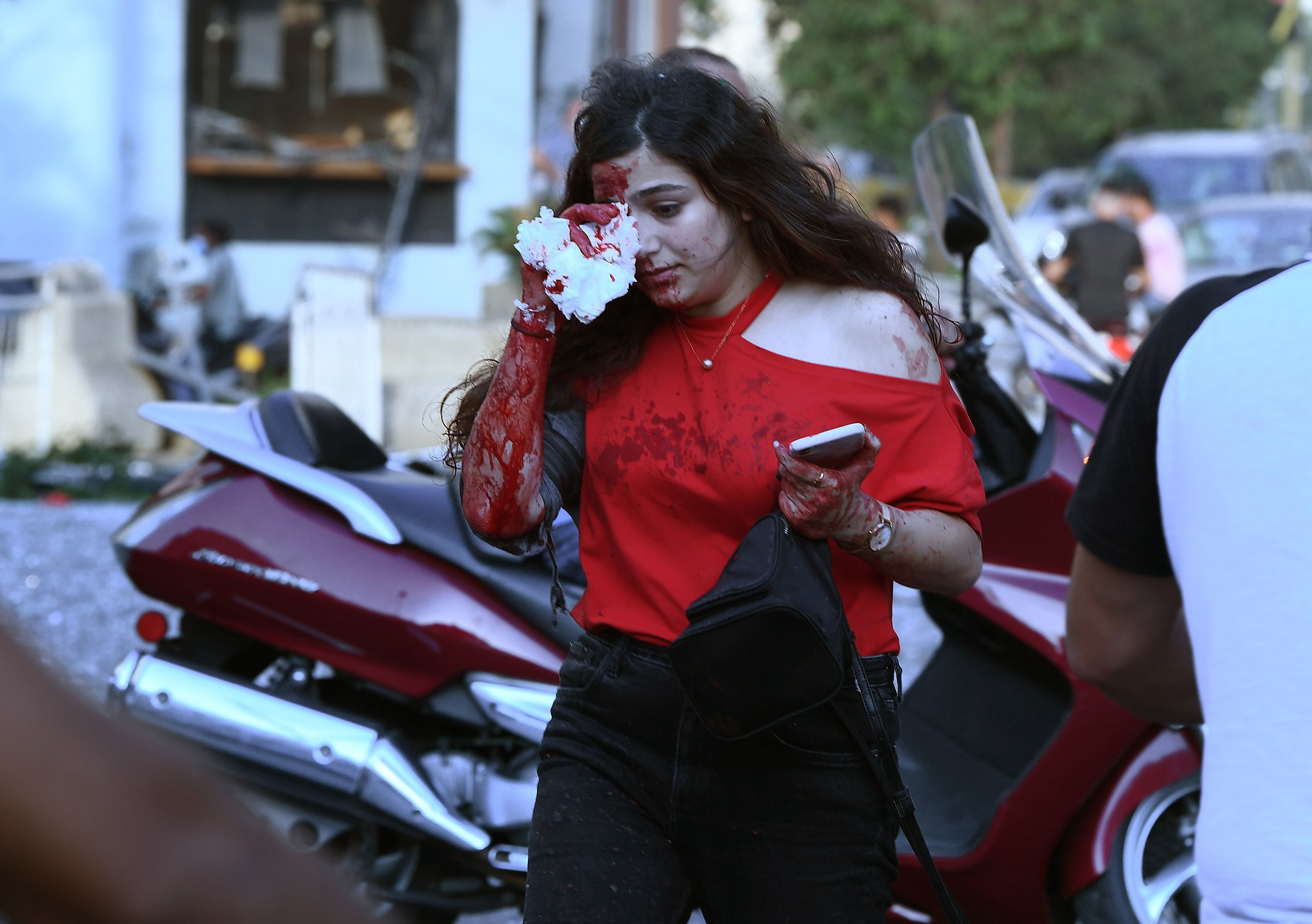 A woman in a red shirt covers her eye, her face, shirt, and arm covered in blood as she walks down the street