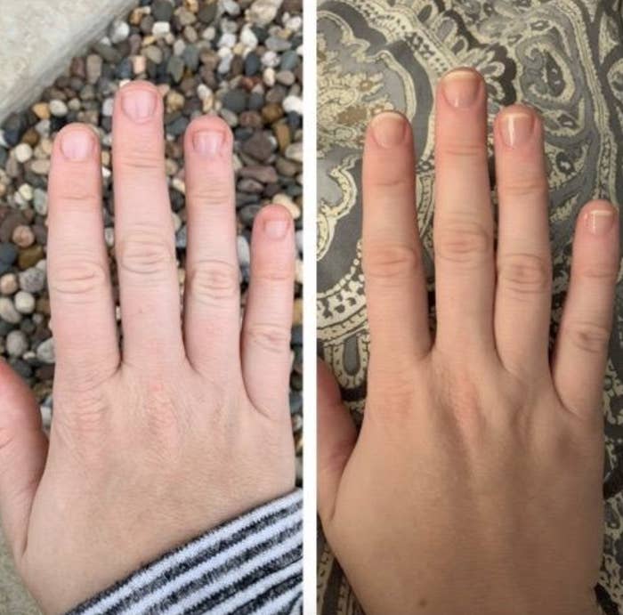 Reviewer&#x27;s before and after photo showing stronger, longer nails in the after photo