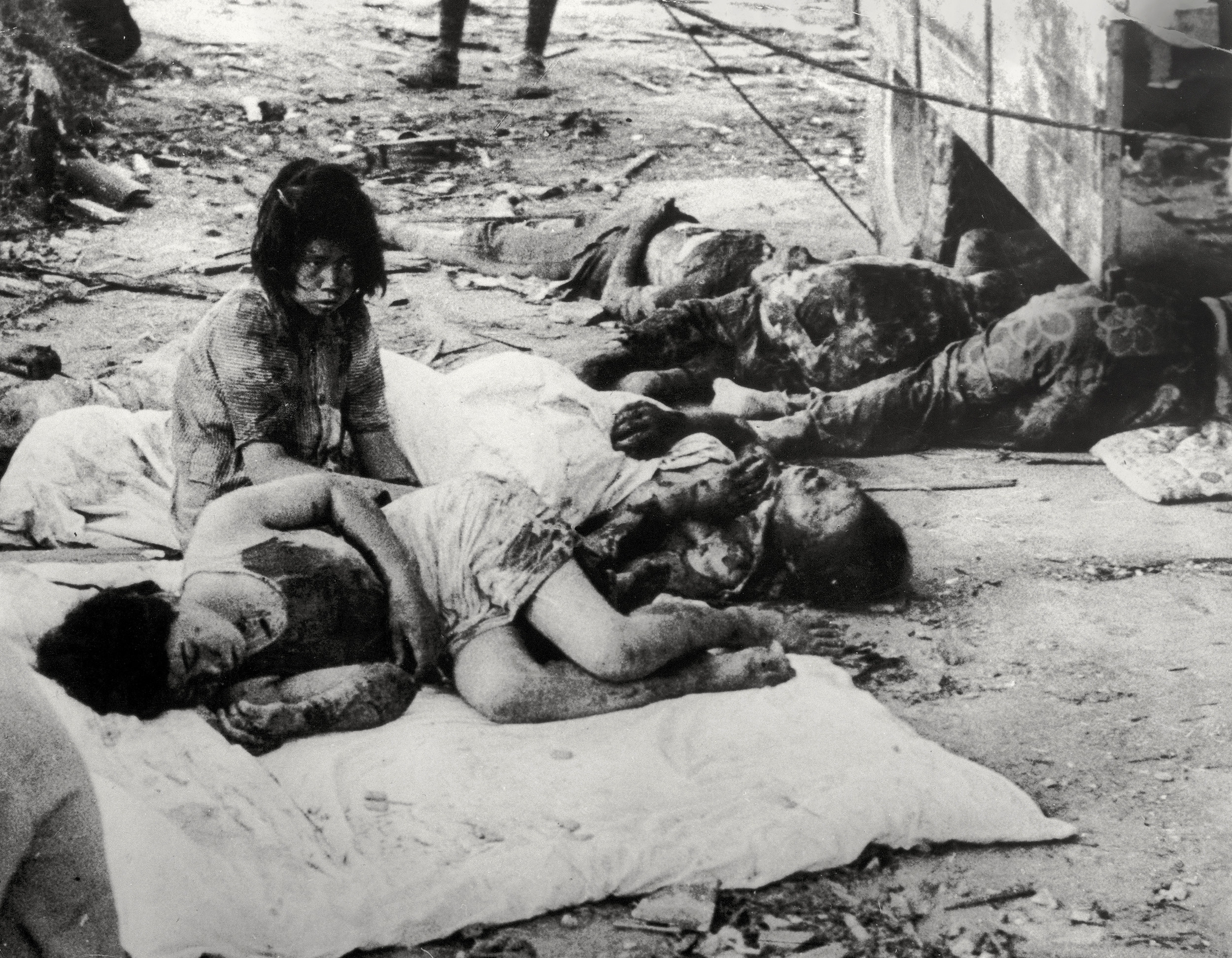 A young girl sits by four badly burned and bloodied women lying down on the ground