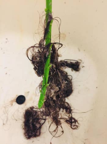 Close up of hairsbreadth removed with drain instrumentality (gross)