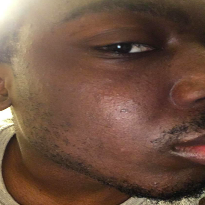 Same reviewer seven days later, face free of irritation 