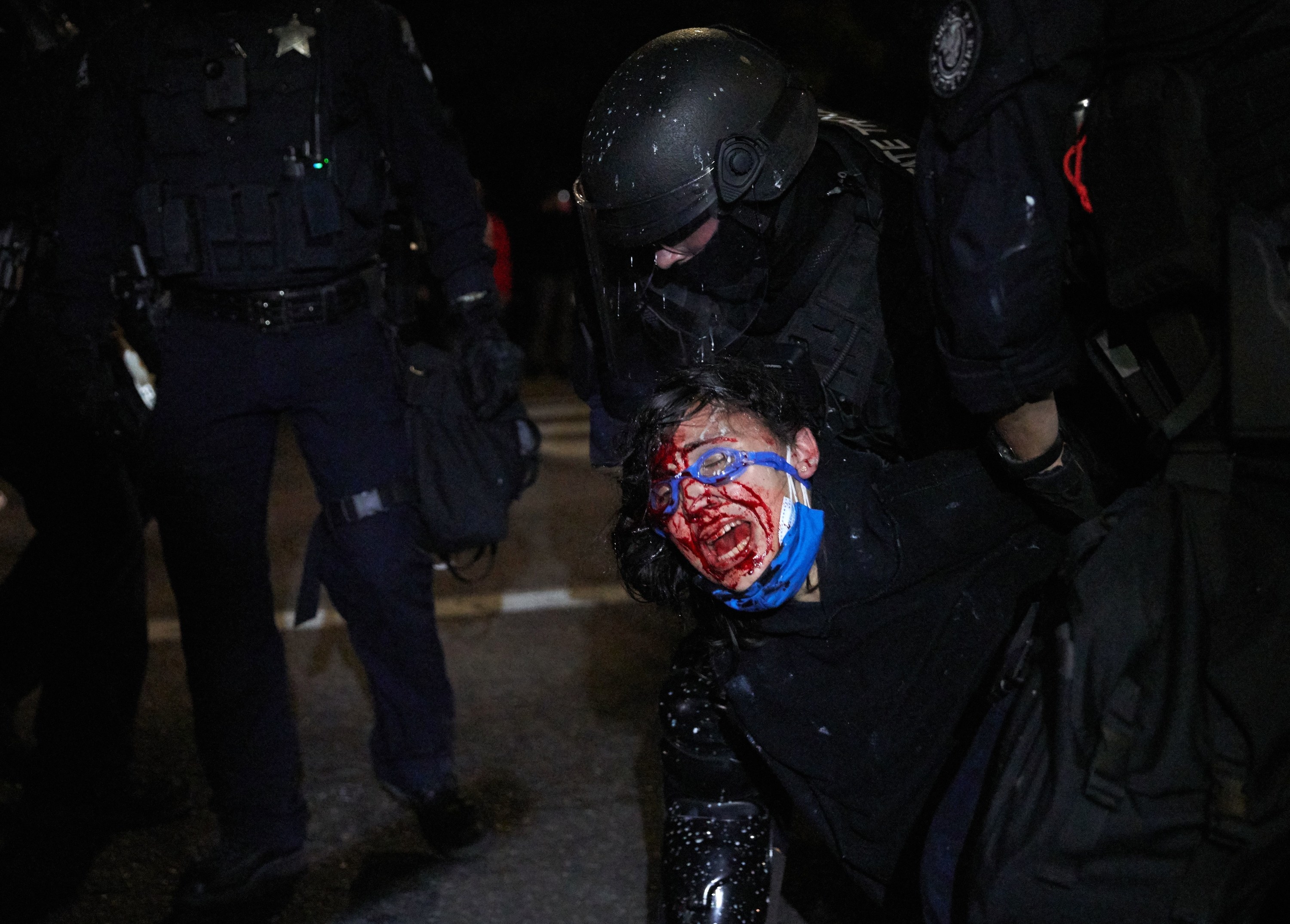 A protester wearing blue goggles shouts and bleeds from the face as a police officer clad in black holds them down