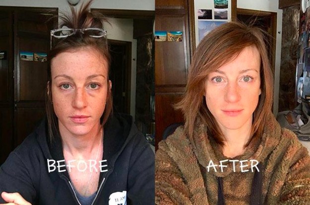 21 Skin-Saving Products With Before And After Pictures That'll Probably Make You Smash That 