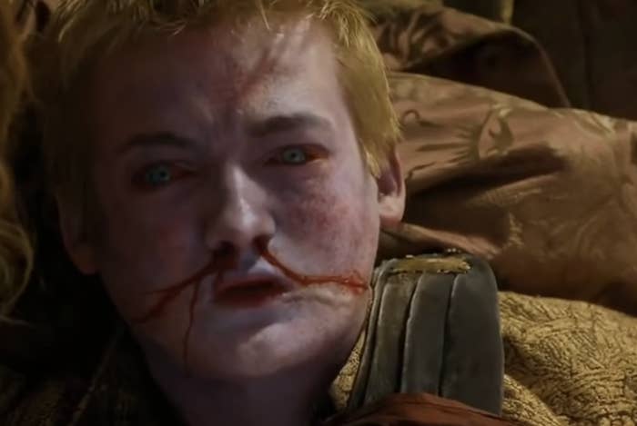 Joffrey with a purple face and blood coming out of his nose after being poisoned