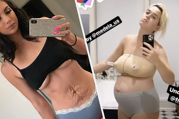 saraaemiliee on Instagram: “Two different body's - both postpartum