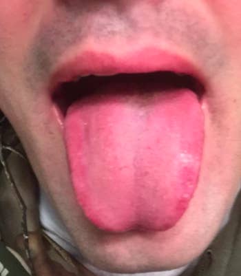 same reviewer's tongue now clean 