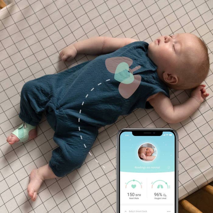 Sleeping baby wearing the sock next to a phone screen showing the baby&#x27;s heart rate and oxygen level