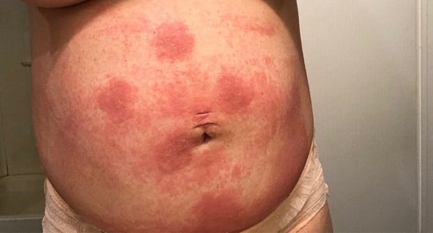 これが産後のリアル 14人のママたちが 画像と共にシェア