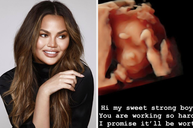 Chrissy Teigen Shared A 3D Sonogram Of Her Baby After Revealing She'd Been Put On 