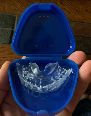 A reviewer&#x27;s molded mouthguard in case