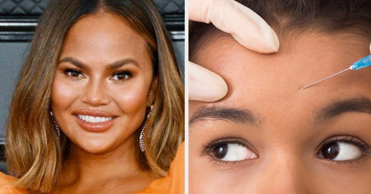 Chrissy Teigen Got Botox For Pregnancy Headaches