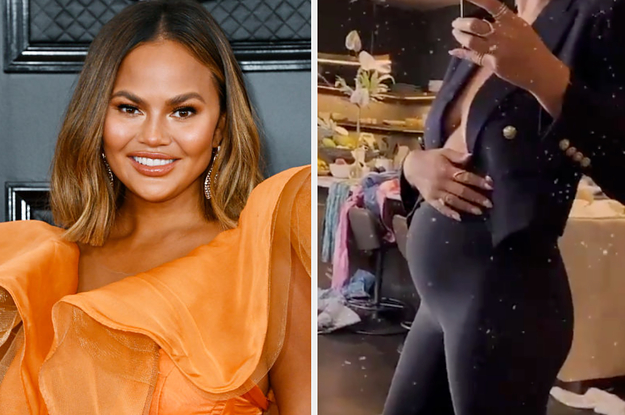 Chrissy Teigen Revealed She Got Botox To Help With Her Pregnancy Headaches And I Just Learned So Much