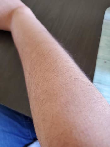 reviewer with hairy arm